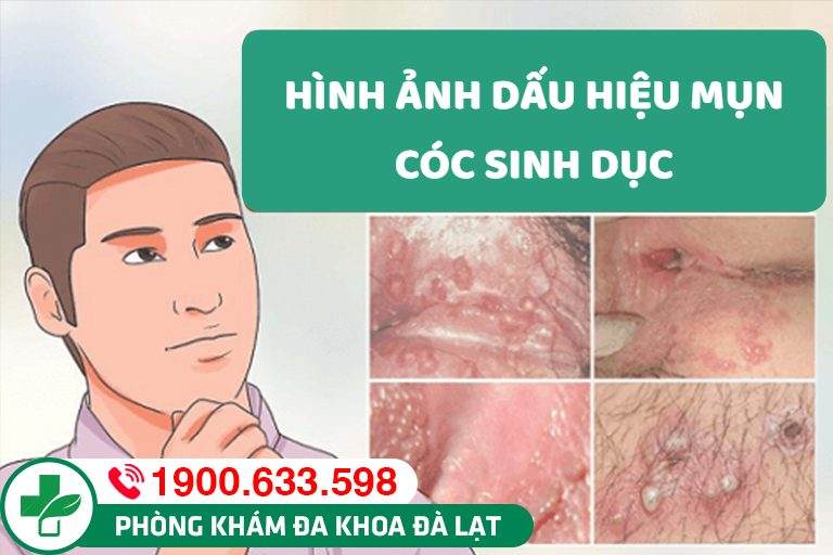 Hình ảnh minh họa